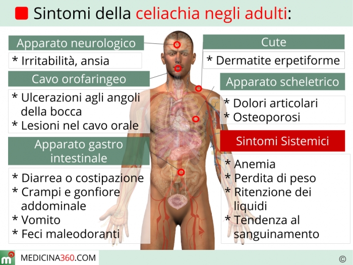 Doença celíaca: sintomas, tratamento e prevenção